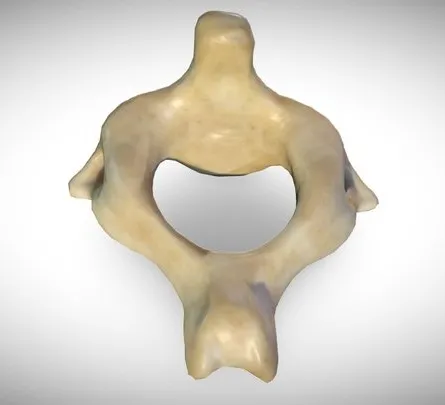 PBR Game 3D Models - 2Nd Cervical Vertebra (Axis)