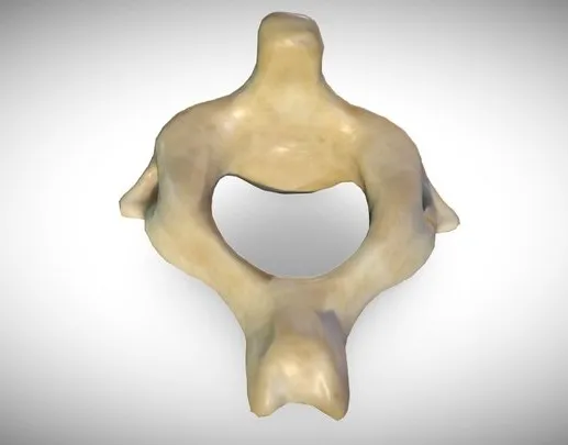 PBR Game 3D Models - 2Nd Cervical Vertebra (Axis)