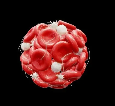 PBR Game 3D Models - Blood Clot Thrombus