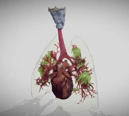 PBR Game 3D Models – Covid 19 Lung Disease Version2 (Animated)